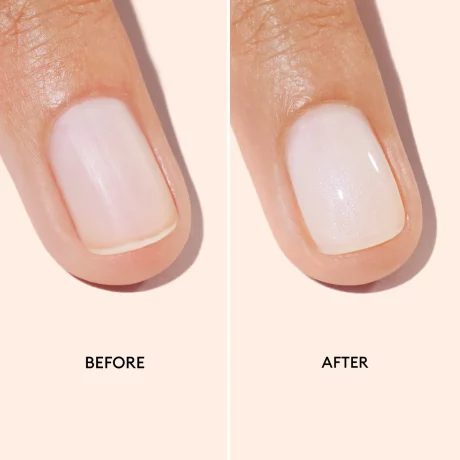 ACTIVE Bright (before_after)